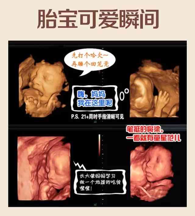 四维彩超如何预测宝宝生成高清AI照片