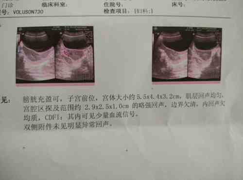 宝宝四维彩超模样，AI绘画预见未来长相生成