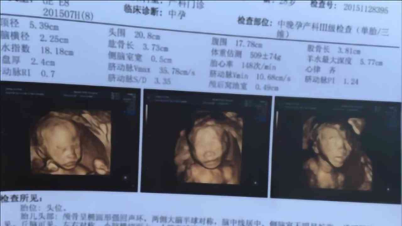 宝宝四维彩超一键转换生成高清照片软件：轻松转换彩超图片为馨相片