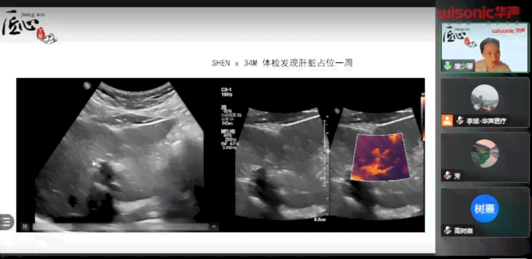 超声质控具体内容包括规范要求与实细节