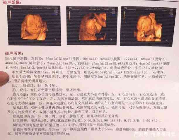 AI预测四维彩超文案撰写技巧与优秀案例分享