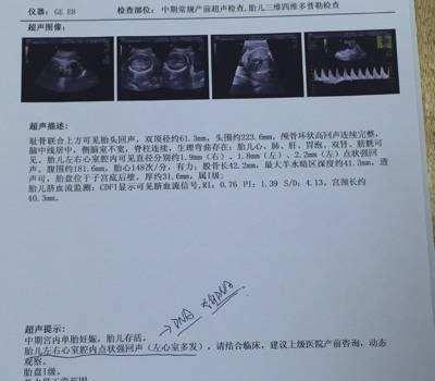 AI预测四维彩超文案撰写技巧与优秀案例分享