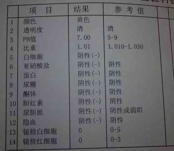 ai血液检查报告多久出来：报告单及结果所需时长解析