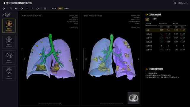 ai识别肺功能报告