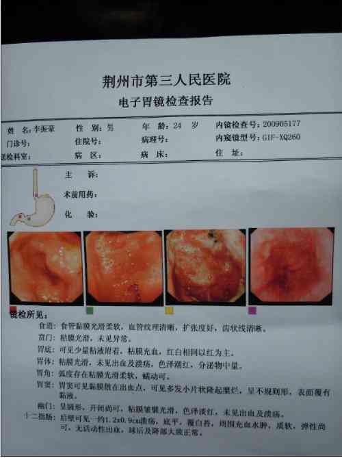 胃镜报告提示需专科检查，医生建议究竟是什么？——健网揭秘胃部健奥秘