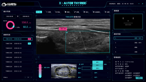 智能AI超声诊断系统：一键生成精准医学报告，提升诊疗效率与准确性
