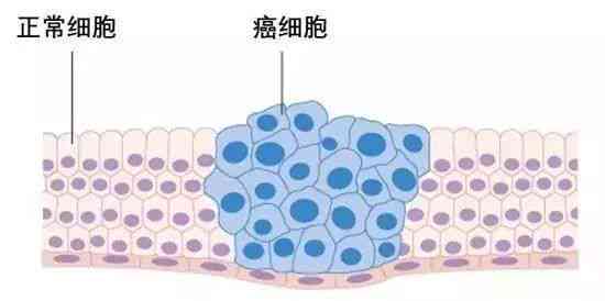 快速准确识别癌细胞：全新AI驱动的细胞识别应用实现90秒内高精度检测