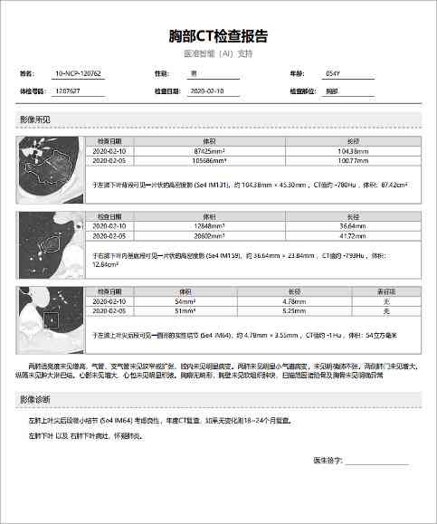 ct报告上ai是