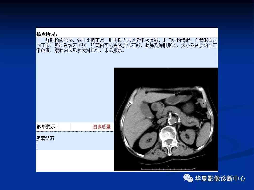 影像诊断报告书写规范与文库：打造专业报告书标准