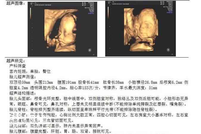 四维预测：宝宝长相生成软件如何利用彩超数据预测文案哪些特点