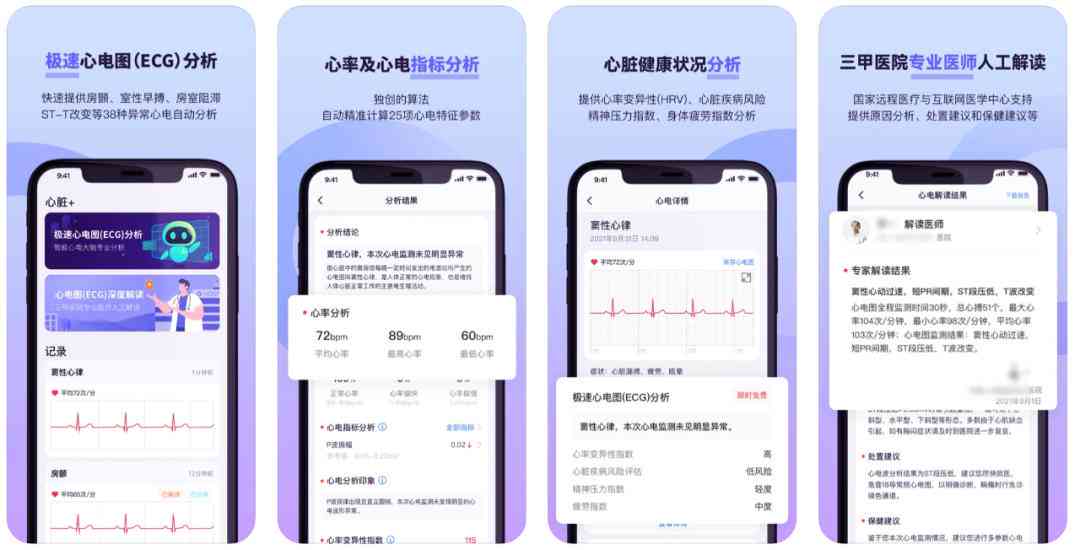 智能AI心电分析报告：全方位解读与疾病预警诊断