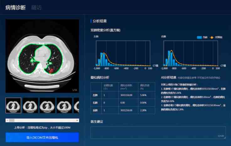 体检报告ai是什么病