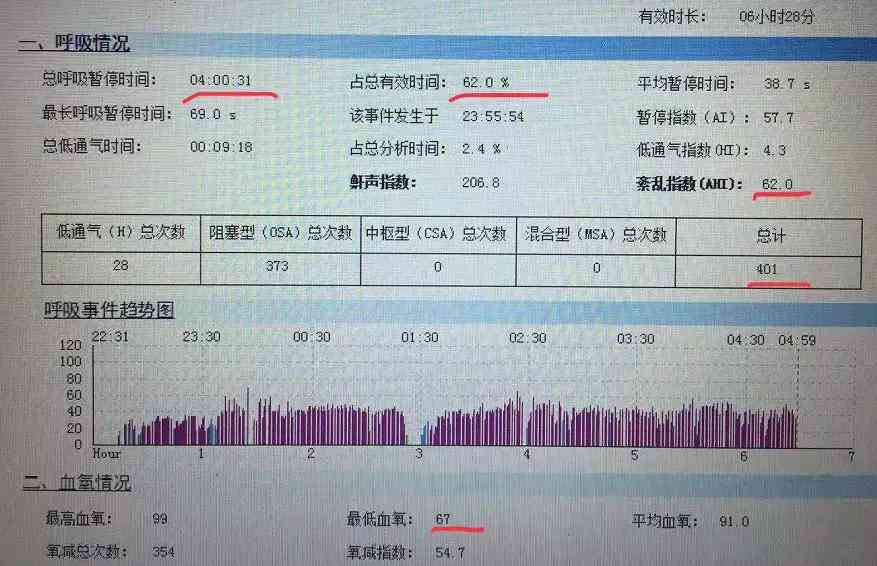 监测报告揭秘：睡眠中的AHI吸指数究竟是什么，吸机如何影响睡眠质量？