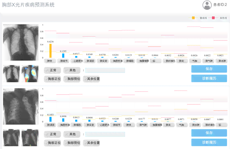 智能医院检查报告分析软件推荐：一键解读各类医疗报告与诊断结果