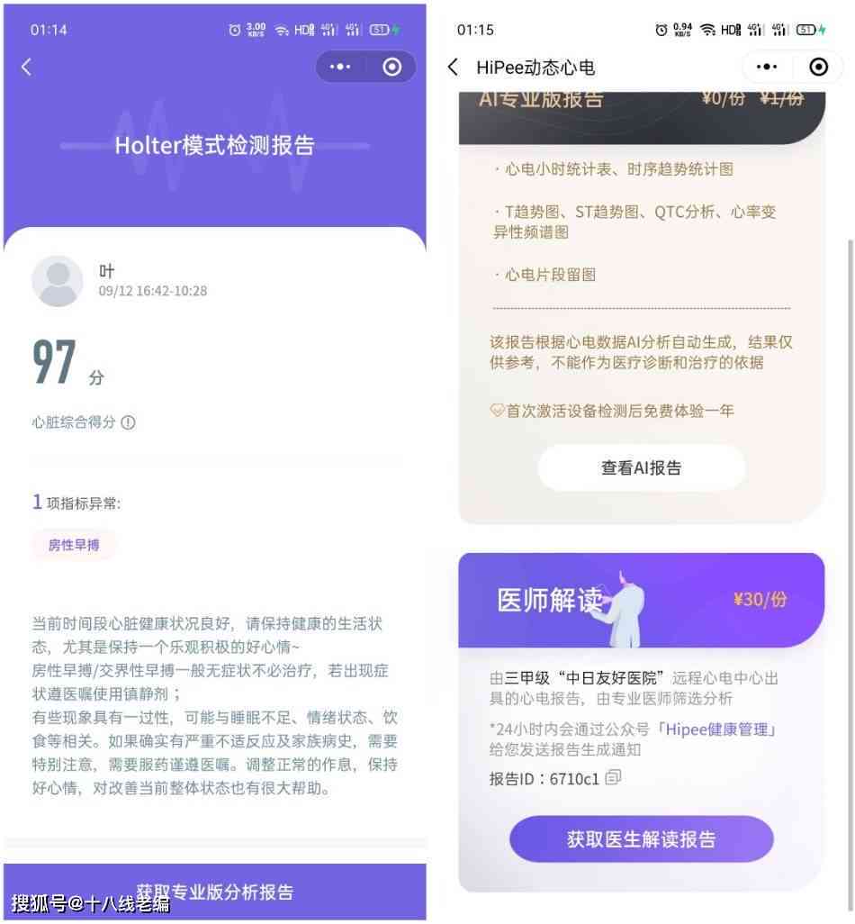 ai诊断报告模板安装 - 手机版官网直链