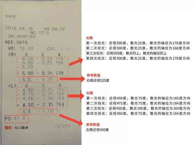 视力报告怎么解读：全面解析报告单的正确查看方法