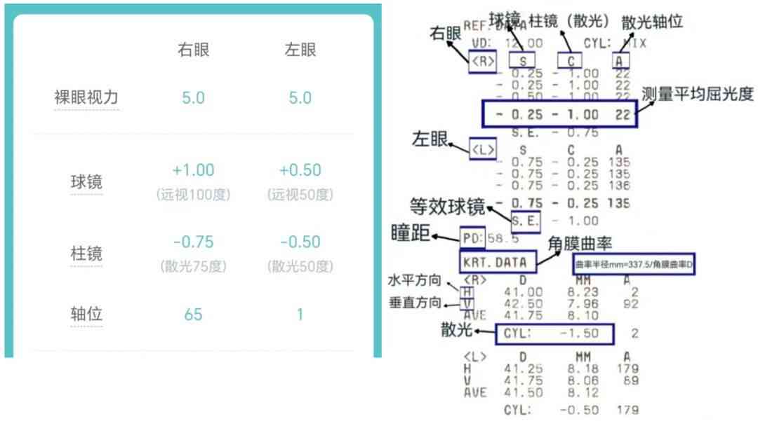 解读视力报告ai