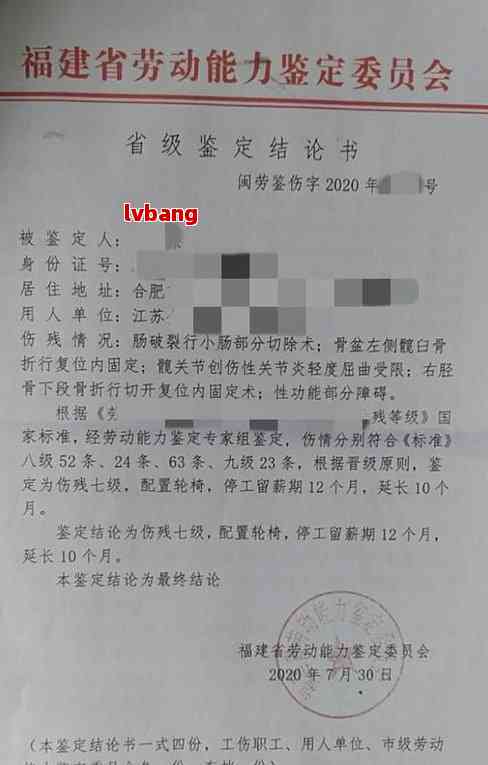 渭南工伤认定中心电话：查询鉴定中心联系方式