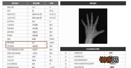 ai骨龄检测评估报告怎么看：解读结果与评价报告单详解