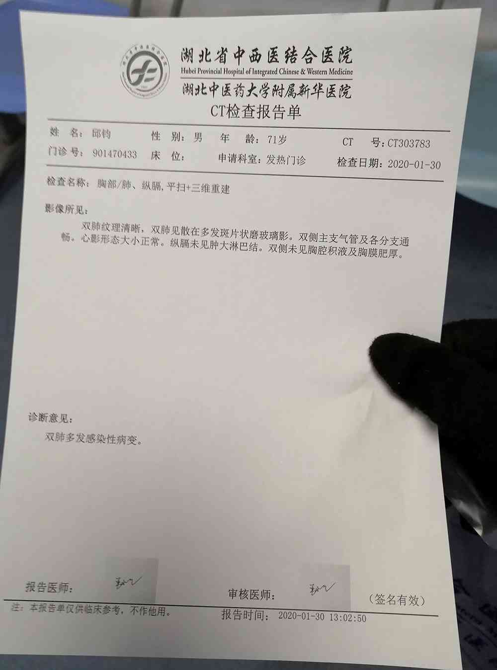 ct片报告单-ct片报告单能取第二次吗