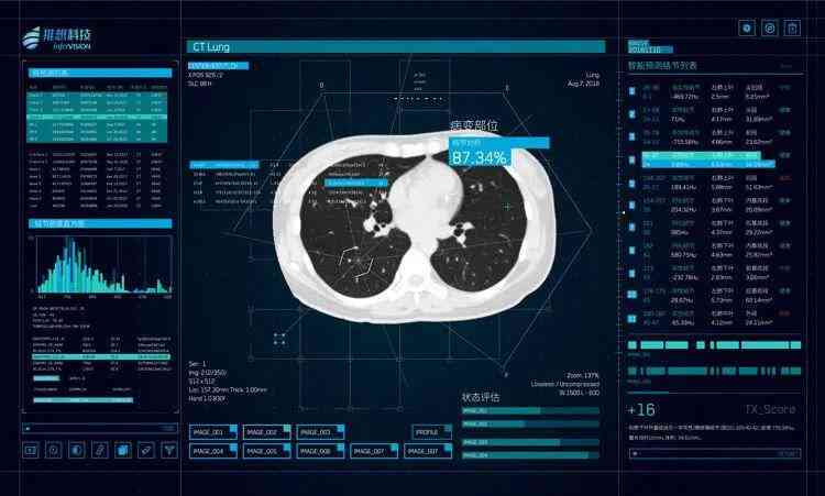 ai读片ct报告