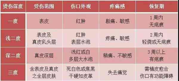 轻微一度烧伤是否构成工伤认定标准解析