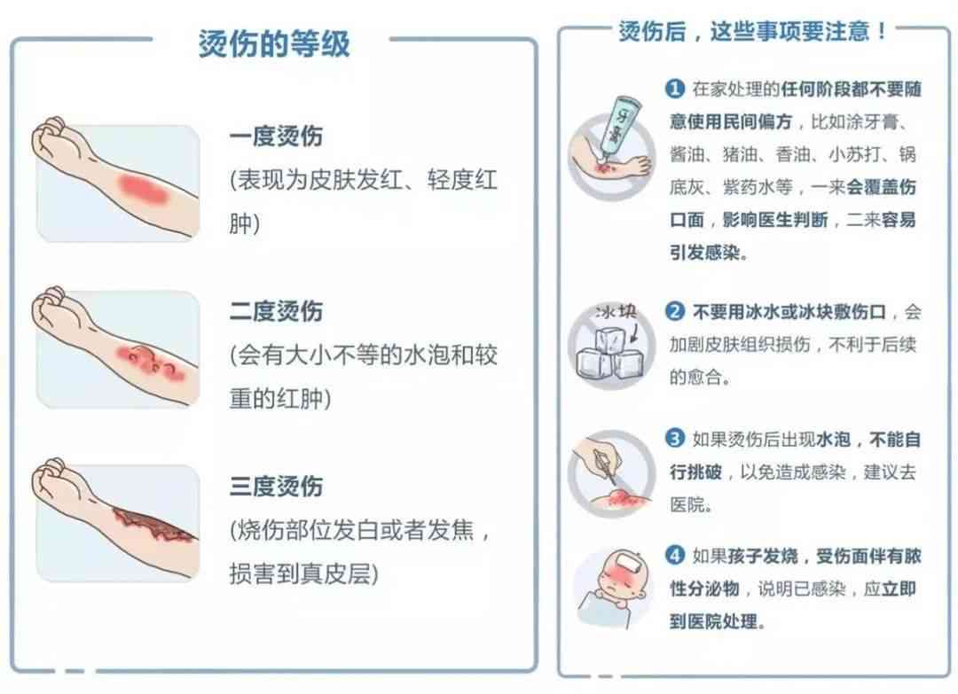 胳膊烧伤急救处理与居家护理指南：如何快速缓解疼痛、预防感染与促进愈合