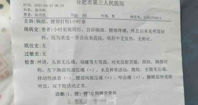 三根肋骨骨折工伤认定标准及赔偿详解