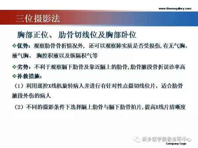 全面解析：三根肋骨骨折工伤全赔偿项目及标准一览