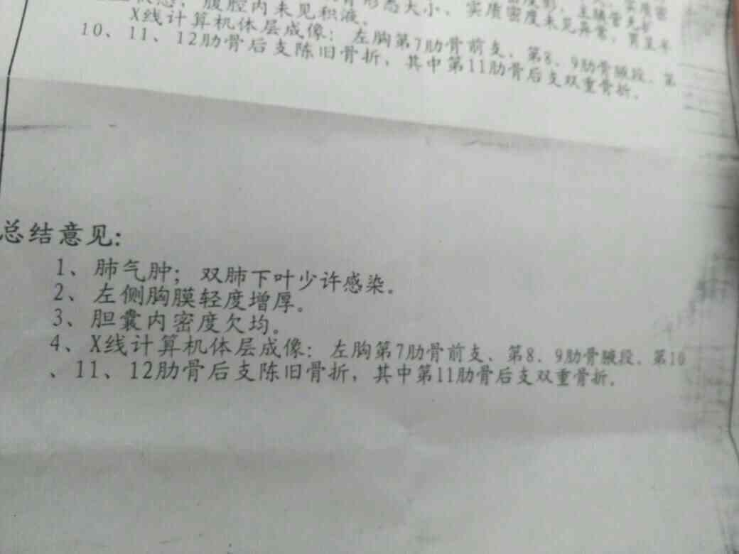 三根肋骨认定工伤几级啊