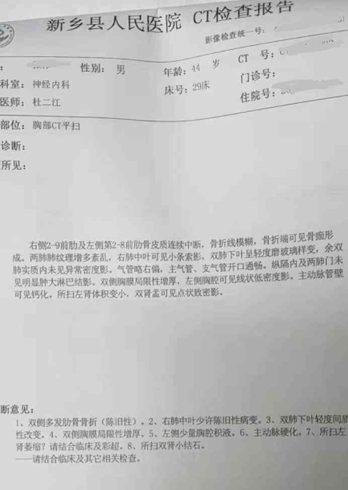 三根肋骨骨折工伤等级判定及赔偿标准详解