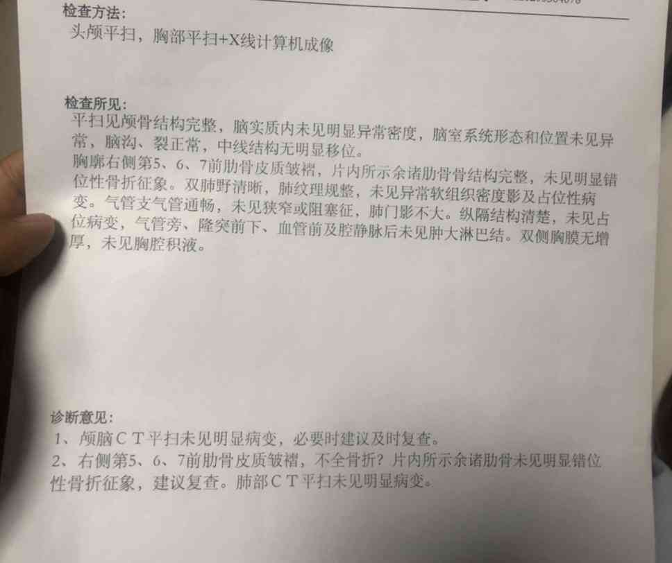 三根肋骨认定工伤吗多少钱