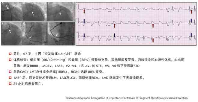 AI心电报告解读：全面解析心电图数据与人工智能的应用前景