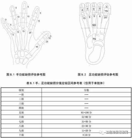 '工伤事故：手部筋骨损伤工伤赔偿计算指南'