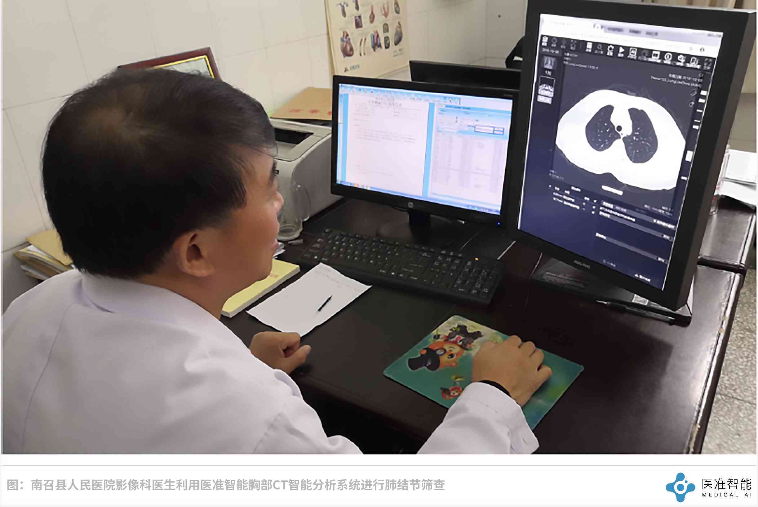 AI智能解析助力快速读懂医院检查报告