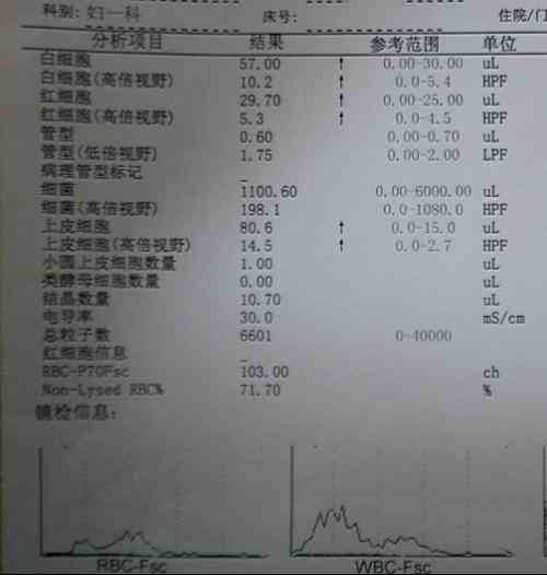 ai解读检验报告单