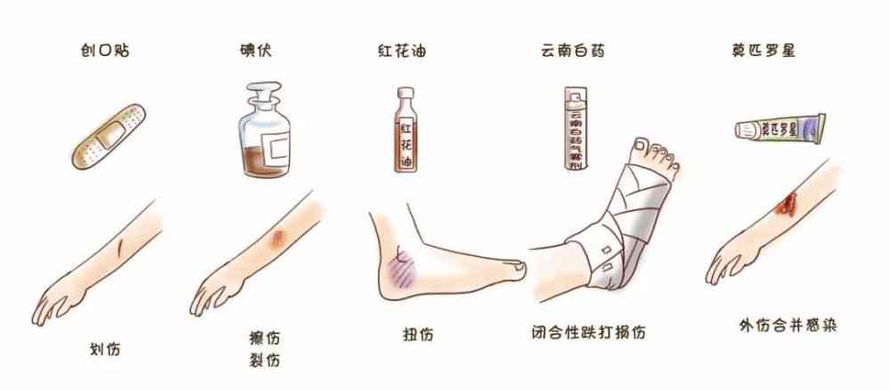 意外伤害界定：不摔伤是否被归类为意外摔伤