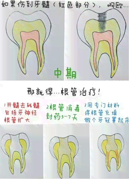 门牙松动程度判定：两颗门牙松动是否构成轻伤及其法律与医疗解读