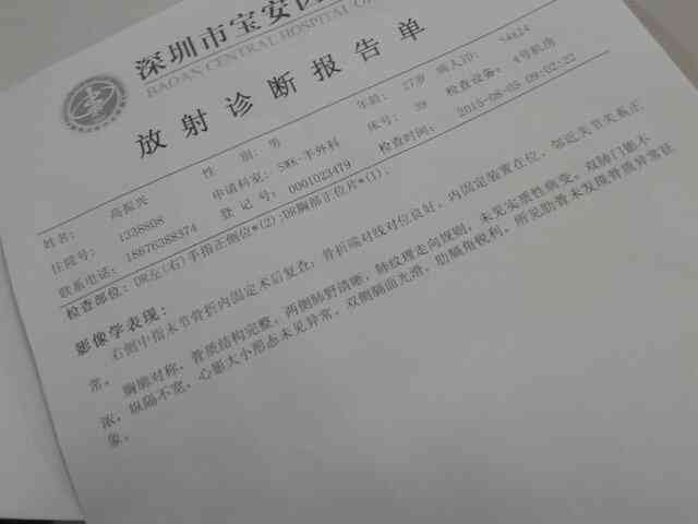 工伤导致中指功能丧失伤残等级评定标准及赔偿指南