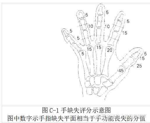 探讨中指功能丧失所对应的工伤等级划分标准