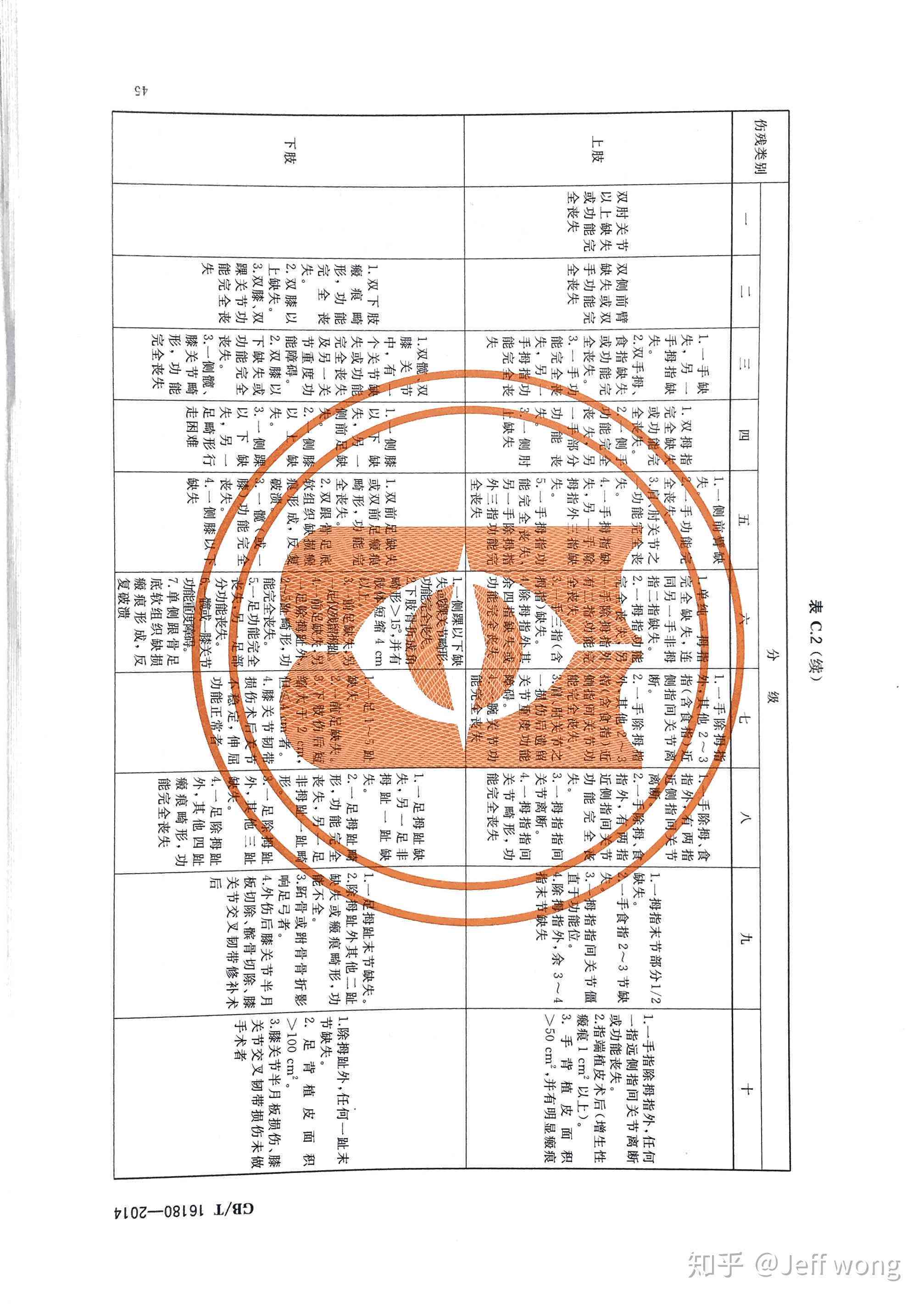 中指功能丧失伤残等级划分及对应伤残级别详解