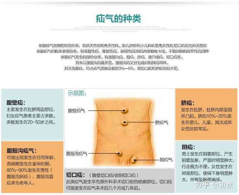 探讨儿与成人疝气高发病率背后的原因及防治策略