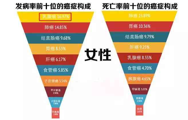 女职工得了乳腺癌能算工伤吗：赔偿标准及退休年龄解析