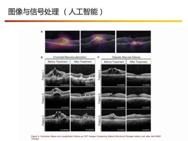 人工智能眼底成像技术综合诊断报告：全面解读眼底健状况与疾病风险