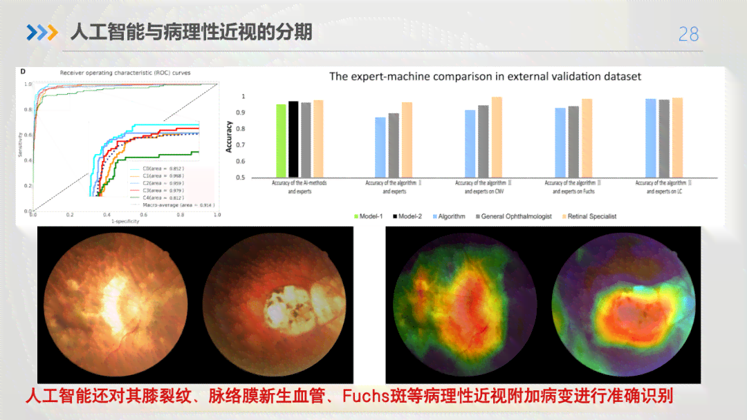 人工智能眼底成像技术综合诊断报告：全面解读眼底健状况与疾病风险