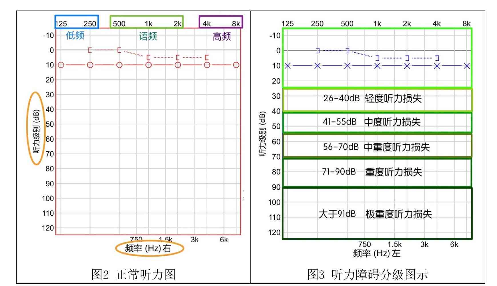 听力测试8db：安仪器数值表报告单解读与正常值标准