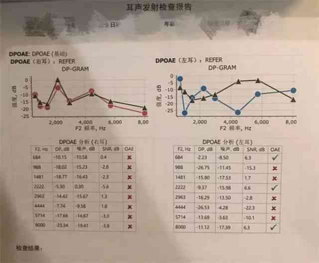 听力测试8db：安仪器数值表报告单解读与正常值标准