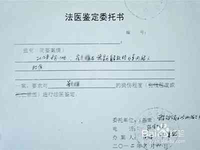 工伤认定标准：详解哪些伤情合工伤条件