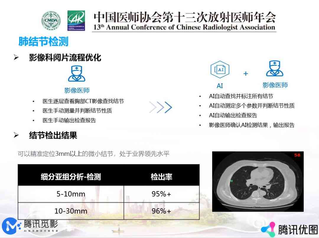 微小肺结节检出率显著提升：健体检中的早期筛查新趋势