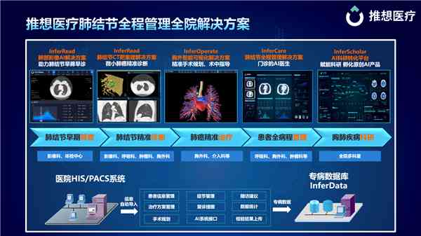 全功能肺结节智能分析软件：精准诊断与跟踪管理一站式解决方案